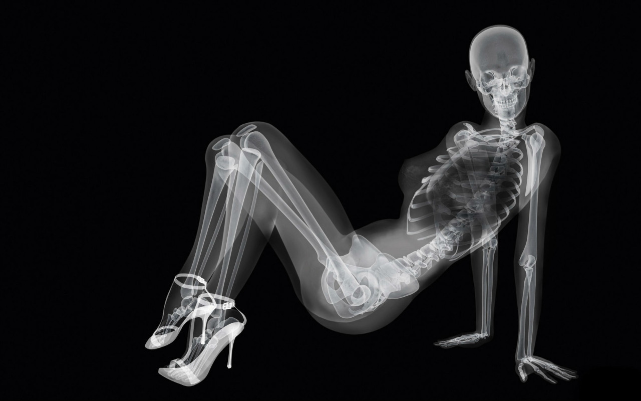 Рентгеновский снимок скелета
