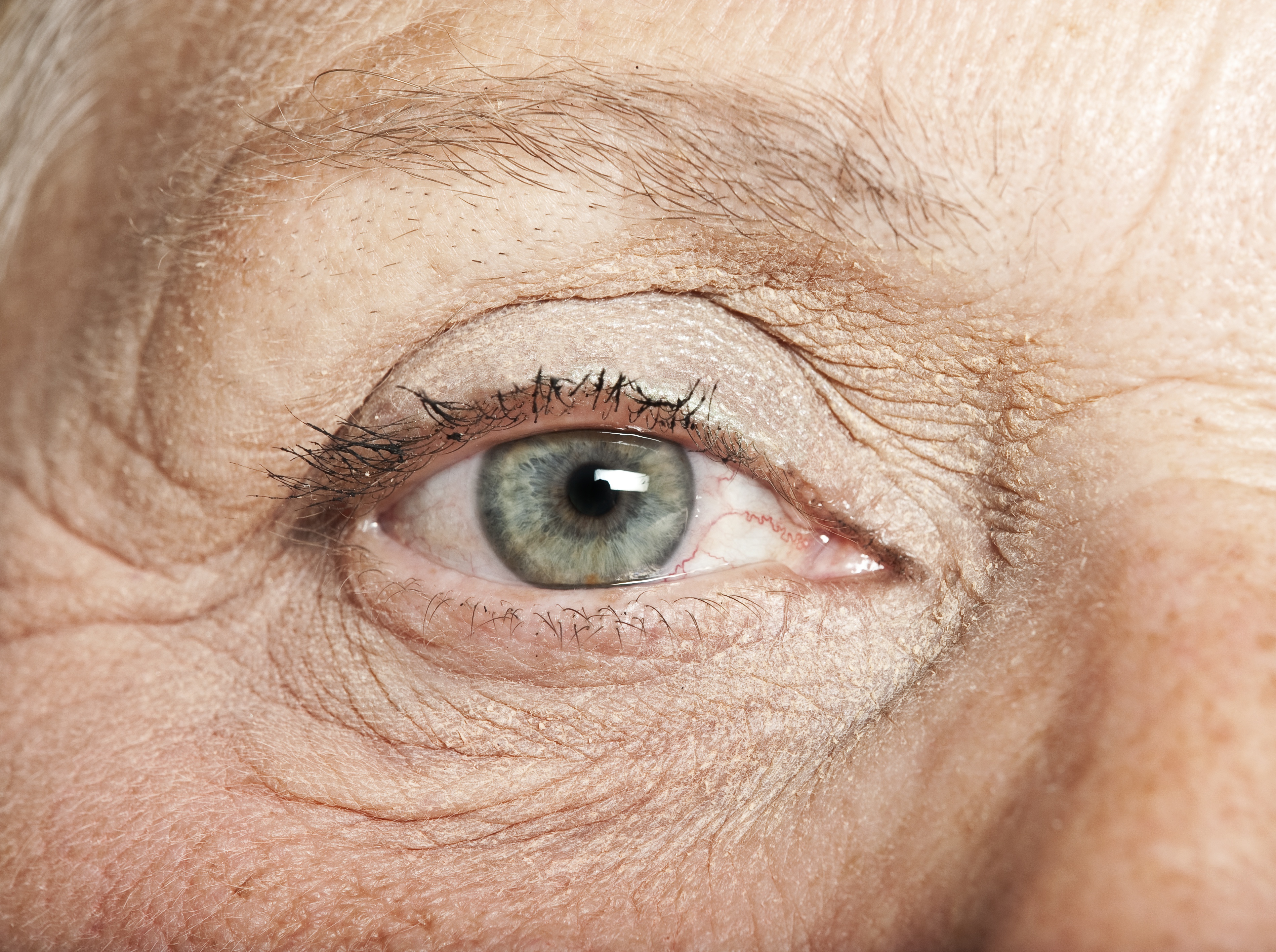 заболевания глаз в пожилом возрасте картинки