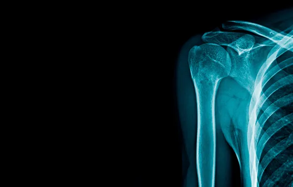 Blue, bones, x-ray