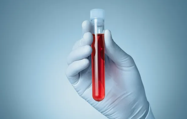 Blood, gloves, sample