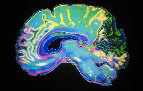 Картинка brain, radiography, dye color