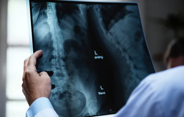 Doctor, medical, study, x-ray