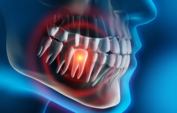 Картинка pain, teeth, tooth