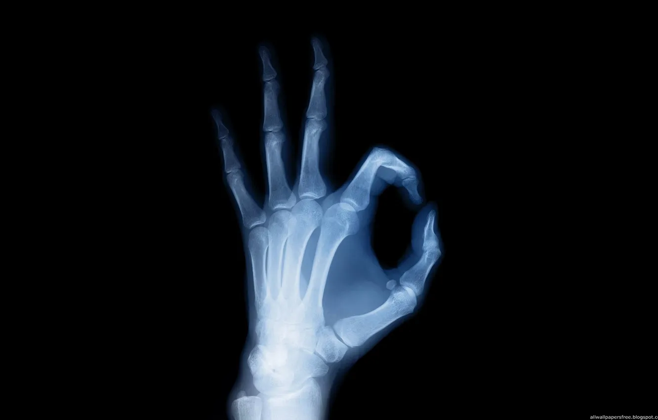 Фото обои рука, кости, скелет, Рентген
