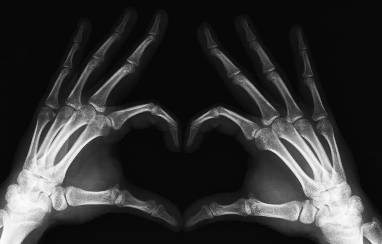 Фото обои Руки, Рентген, Конечности, Пальцы