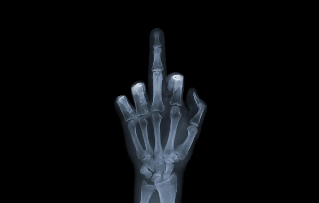 Фото обои обои, рука, кости, рентген, wallpaper, снимок, фак ю, Fuck You