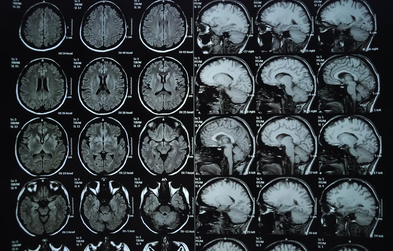 Фото обои skull, brain, X-rays